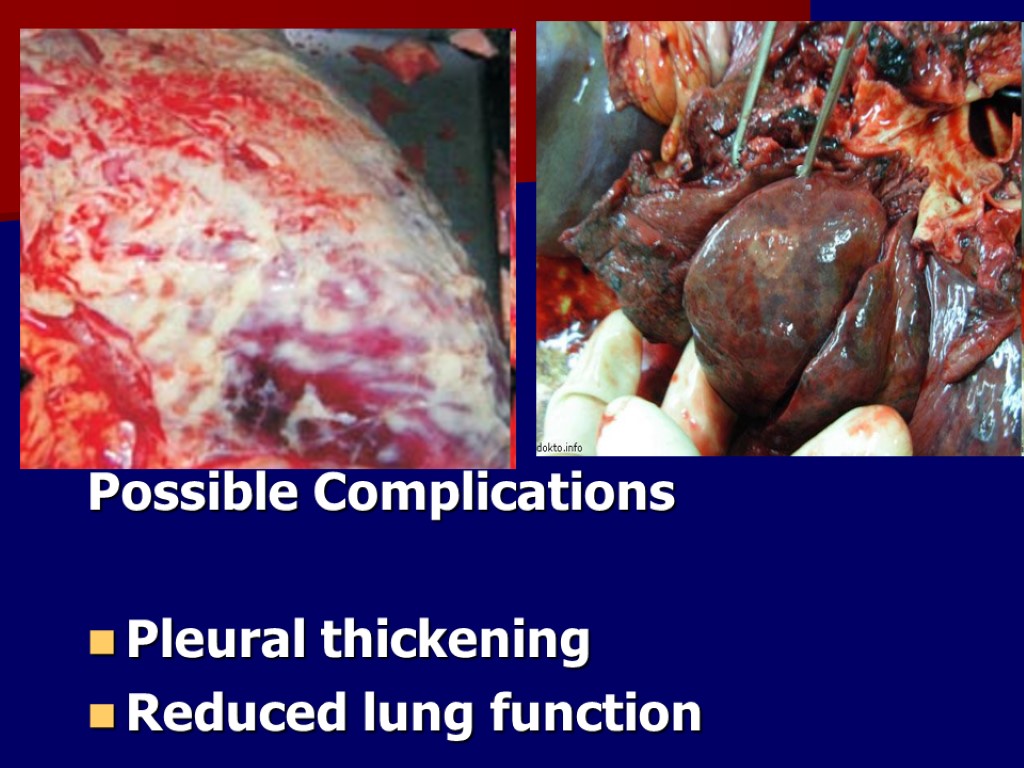 Possible Complications Pleural thickening Reduced lung function